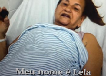 3º Mutirão de mamoplastia redutora. Depoimento da Lela